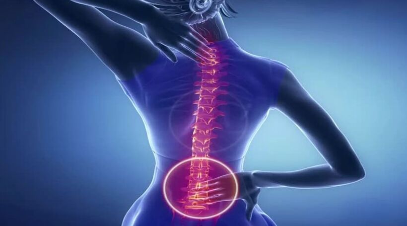Bizkarrezurraren osteokondrosia