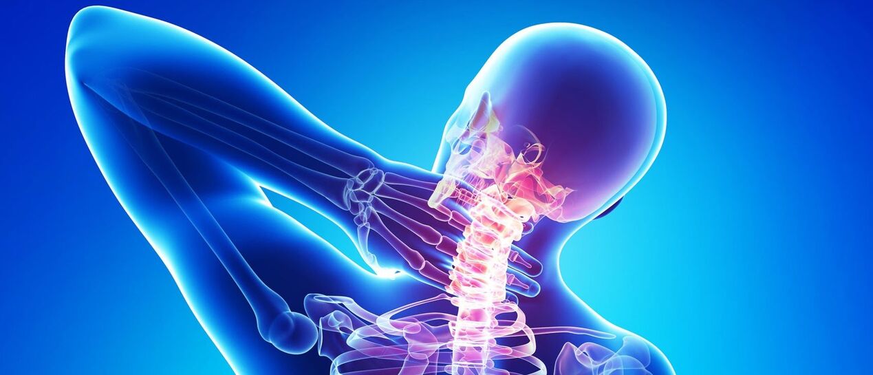 Cervical Osteokondrosia bizkarrezurreko eremuan prozesu patologikoa da