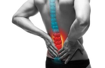 Osteokondrosia bizkarrezurreko gaixotasuna da